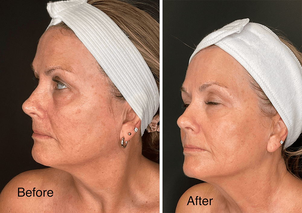 Photos courtesy of Beam